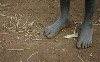 feet