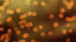 Bokeh Glitter Motion Loop